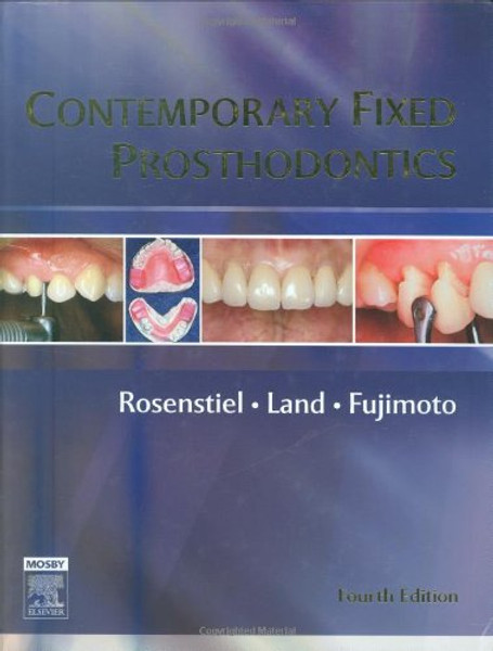 Contemporary Fixed Prosthodontics, 4e