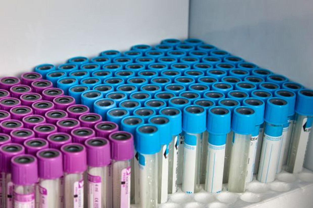 Everything You Need To Know About Vacutainers