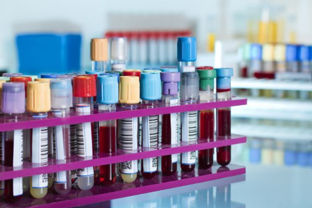 Mistakes To Avoid When Labeling Specimens Mistakes To Avoid When Labeling Specimens