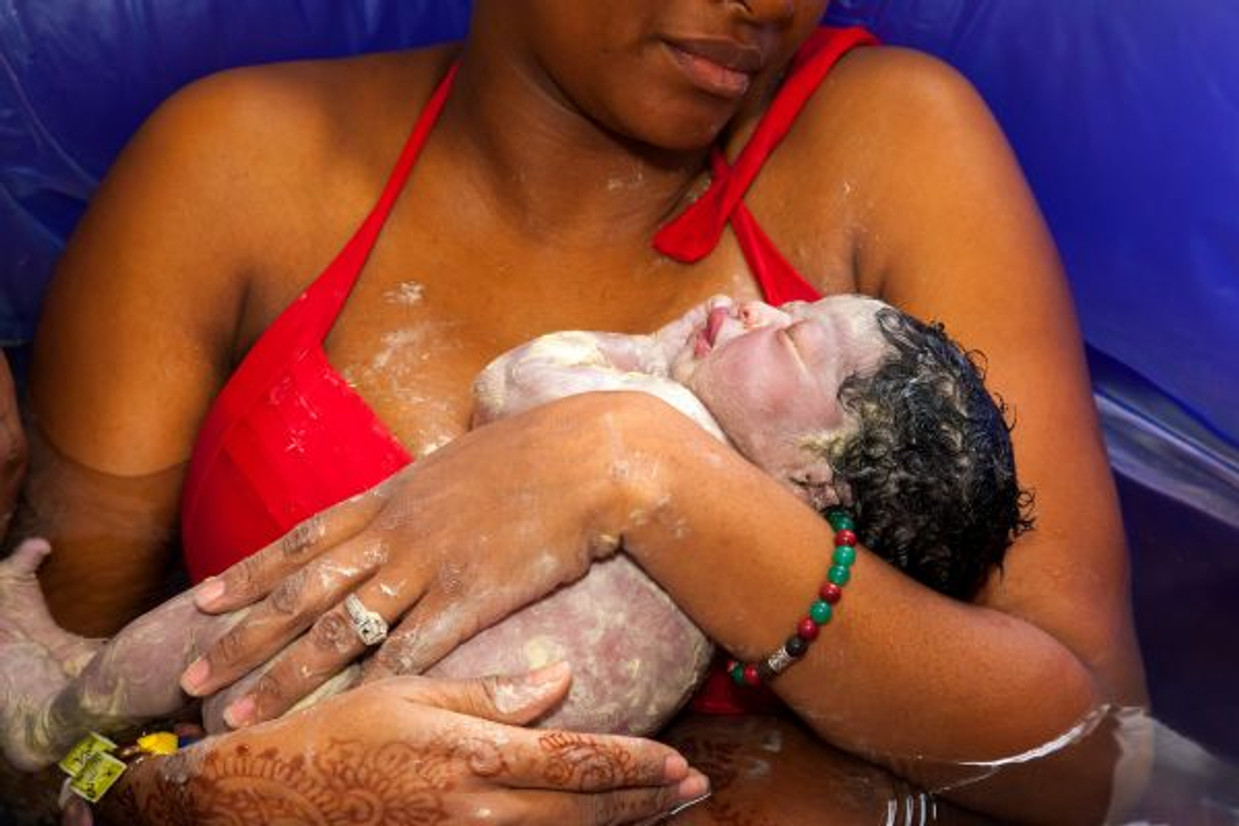 Concerns of Water Birth for High-Risk Pregnancies