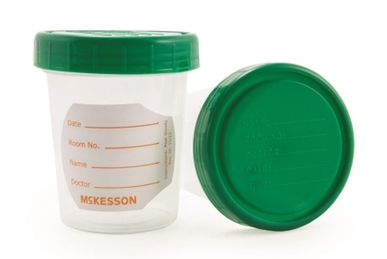 5oz Graduated Urine Collection Container with Snap Cap Non-Sterile