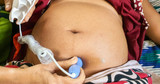 How To Choose the Best Fetal Doppler for Midwifery Practice