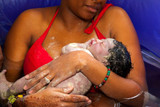Concerns of Water Birth for High-Risk Pregnancies