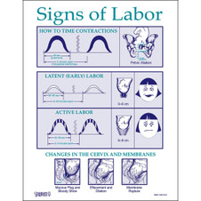 Signs of Labor Tear Pad