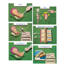 Labor and Birth Intervention Chart Set