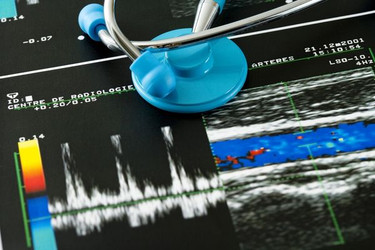 Doppler ultrasound: Uses, what to expect, and results