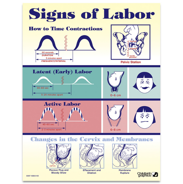 Signs of Labor Tear Pad Signs of Labor Tear Pad