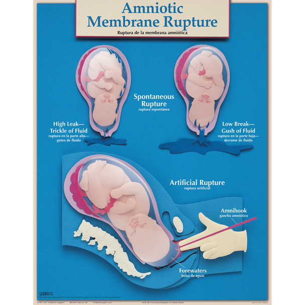 Six Essential Labor & Birth Wall Charts