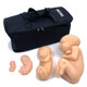 Fetus Model Set