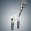 CAD/CAM Ti-Base | Angled Access | Concave Profile | Rotational