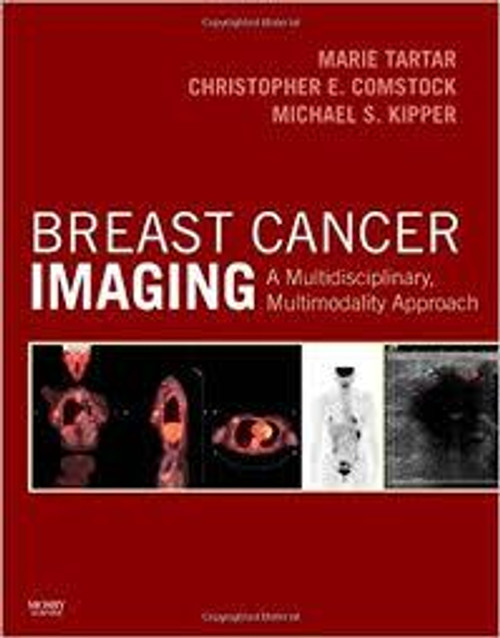 http://axebook.shop/wp-content/uploads/2025/03/breast-cancer-imaging-a-multidisciplinary-multimodality-approach-breast-cancer-imaging-a-multidisciplinary-multimodality-approach.jpg