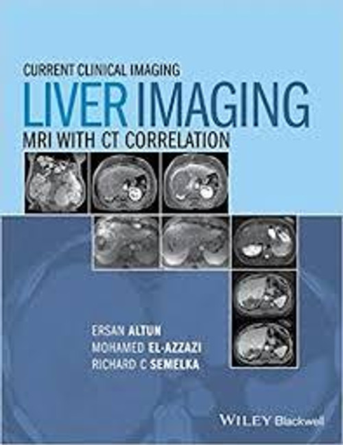 http://axebook.shop/wp-content/uploads/2025/03/liver-imaging-mri-with-ct-correlation-current-clinical-imaging-liver-imaging-mri-with-ct-correlation-current-clinical-imaging.jpg