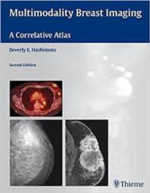 http://axebook.shop/wp-content/uploads/2025/03/multimodality-breast-imaging-a-correlative-atlas-2nd-edition-multimodality-breast-imaging-a-correlative-atlas-2nd-edition.jpg http://axebook.shop/wp-content/uploads/2025/03/multimodality-breast-imaging-a-correlative-atlas-2nd-edition-multimodality-breast-imaging-a-correlative-atlas-2nd-edition.jpg