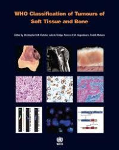 http://axebook.shop/wp-content/uploads/2025/03/who-classification-of-tumours-of-soft-tissue-and-bone-iarc-who-classification-of-tumours-original-pdf-who-classification-of-tumours-of-soft-tissue-and-bone-iarc-who-classification-of-tumours-original.jpg