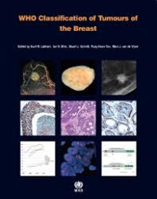 http://axebook.shop/wp-content/uploads/2025/03/who-classification-of-tumours-of-the-breast-iarc-who-classification-of-tumours-original-pdf-who-classification-of-tumours-of-the-breast-iarc-who-classification-of-tumours-original-pdf.jpg