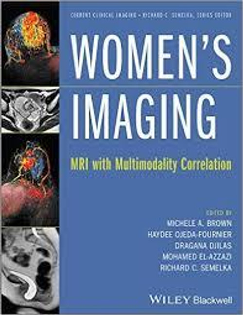 http://axebook.shop/wp-content/uploads/2025/03/women-s-imaging-mri-with-multimodality-correlation-women-s-imaging-mri-with-multimodality-correlation-current-clinical-imaging.jpg