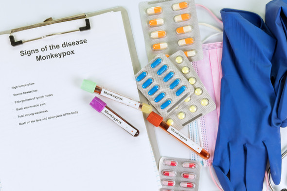 Monkeypox analysis Monkeypox analysis