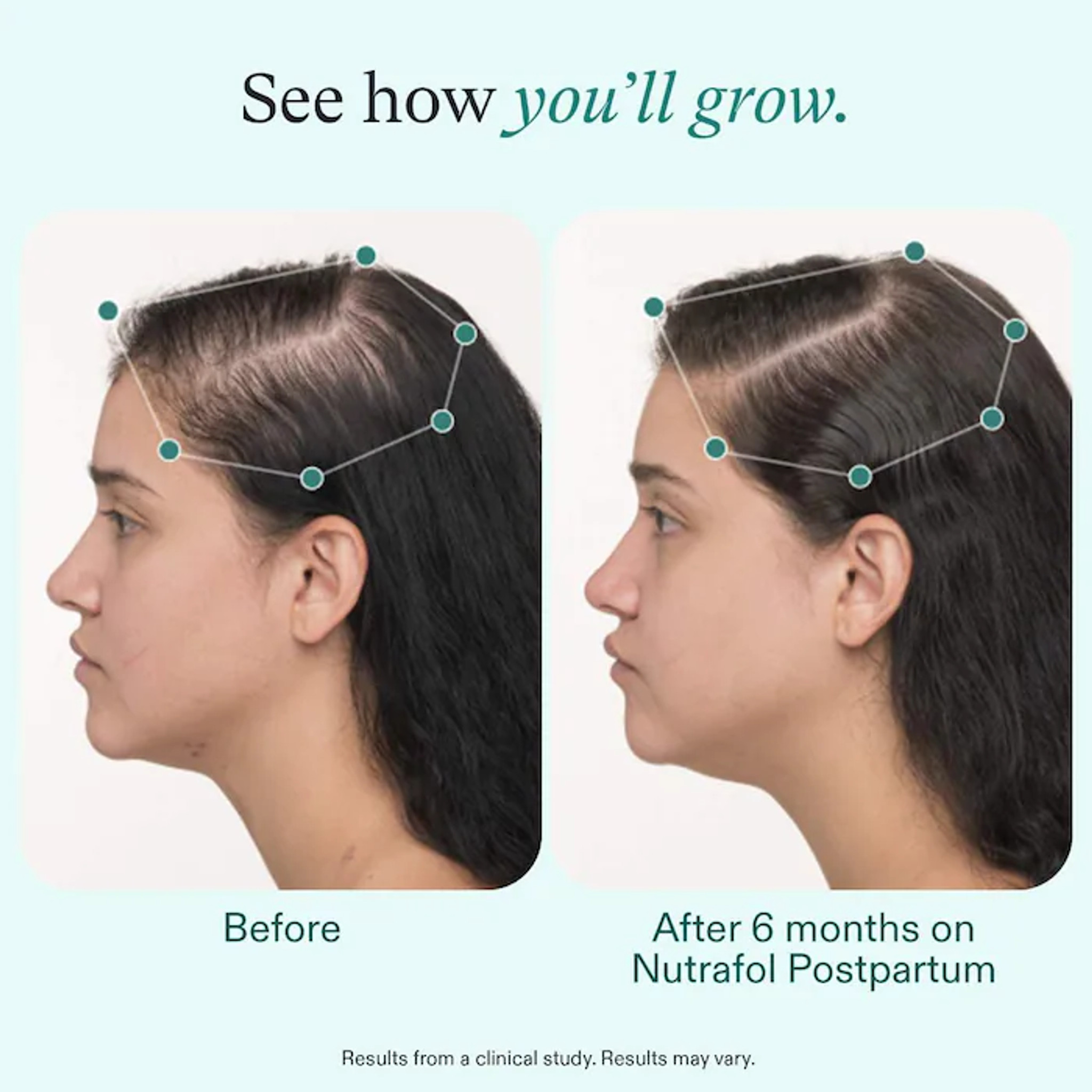 Nutrafol Postpartum Hair Growth Supplement