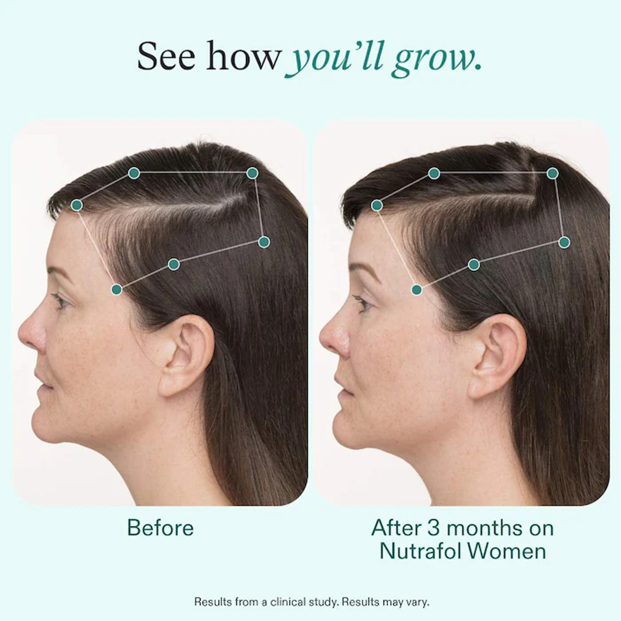 Nutrafol Women's | Hair Growth Supplement (3-Month Supply)