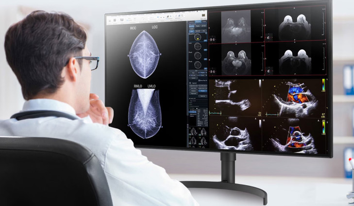 LG 32' 32HL512D-B IPS Diagnostic, Multi-Input, PBP,  Height Adjust, Realistic Colour, Pathology Mode, Monitor. Project and Professional