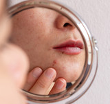 Ask the experts: What is stress doing to my skin?  