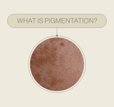 What is pigmentation? 