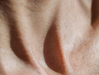 Ageing Skin