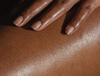 Dry Skin