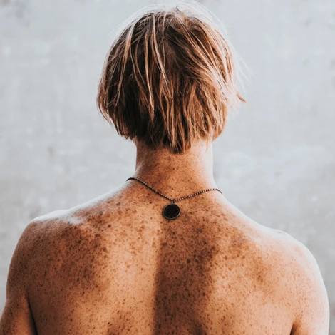 5 Habits Dermatologists Use to Fight Pigmentation. Are You Doing Any of Them?