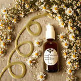 SECOND SKIN was first developed for a client with tinea versicolor and has since been used to heal acne, skin irritation, sunburn, radiation dermatitis, heat burns, eczema and psoriasis.