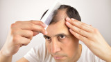 ​Thinning Hair? You are Not Alone