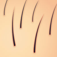 Sensitive, dry or long hair