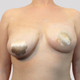 Instant Breast Lift (8 Pairs)