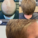 Custom Hair Systems
