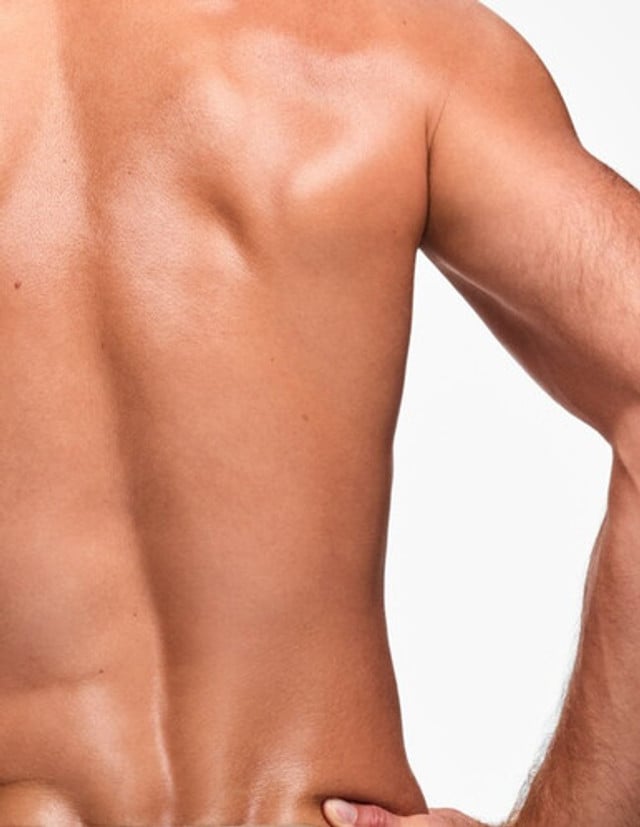 Laser Pigmentation Removal 3/4 Back product image
