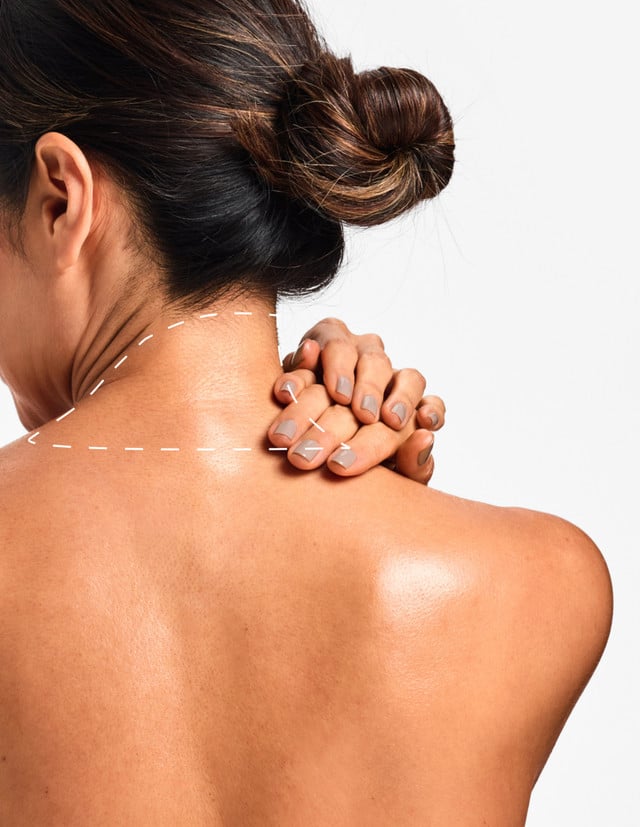 Back of Neck - Laser Hair Removal product image