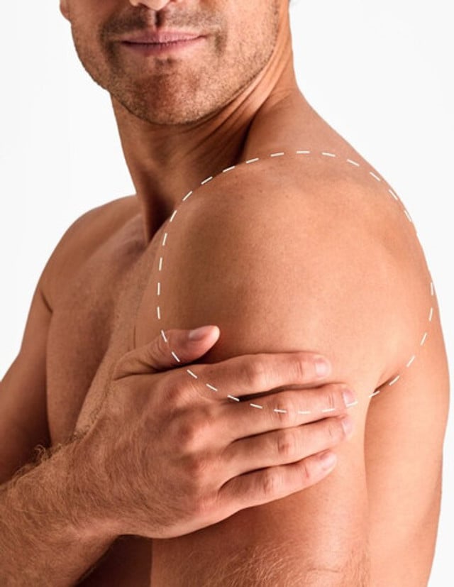 Shoulders - Laser Hair Removal product image