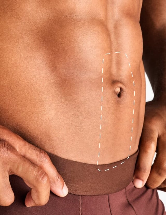 Snail Trail - Laser Hair Removal product image