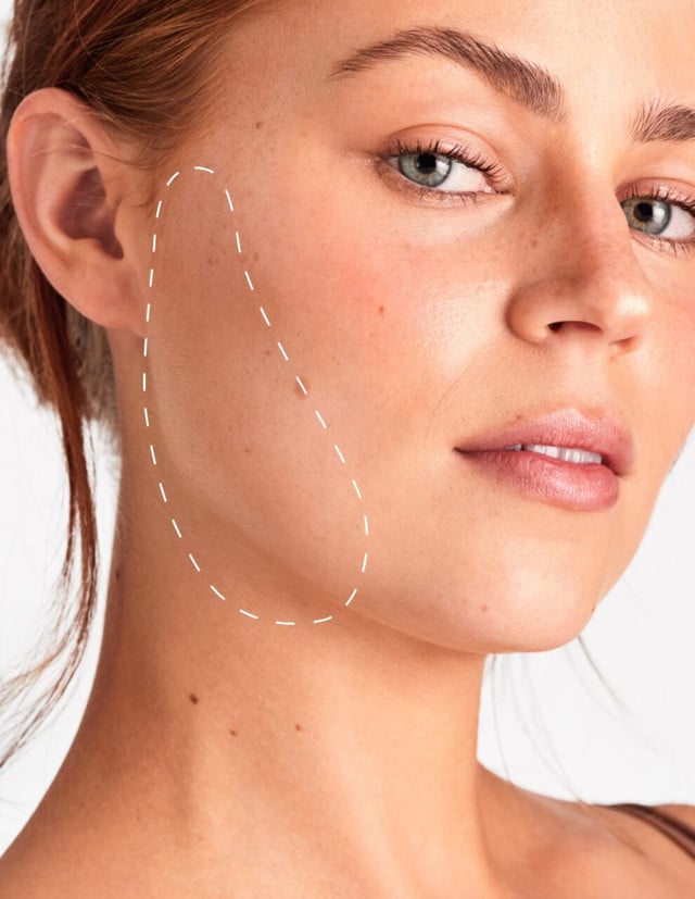 Sides of Face - Laser Hair Removal product image