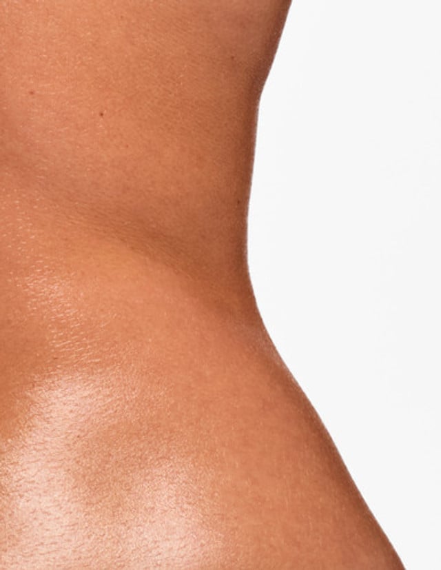 Skin Needling Hips product image