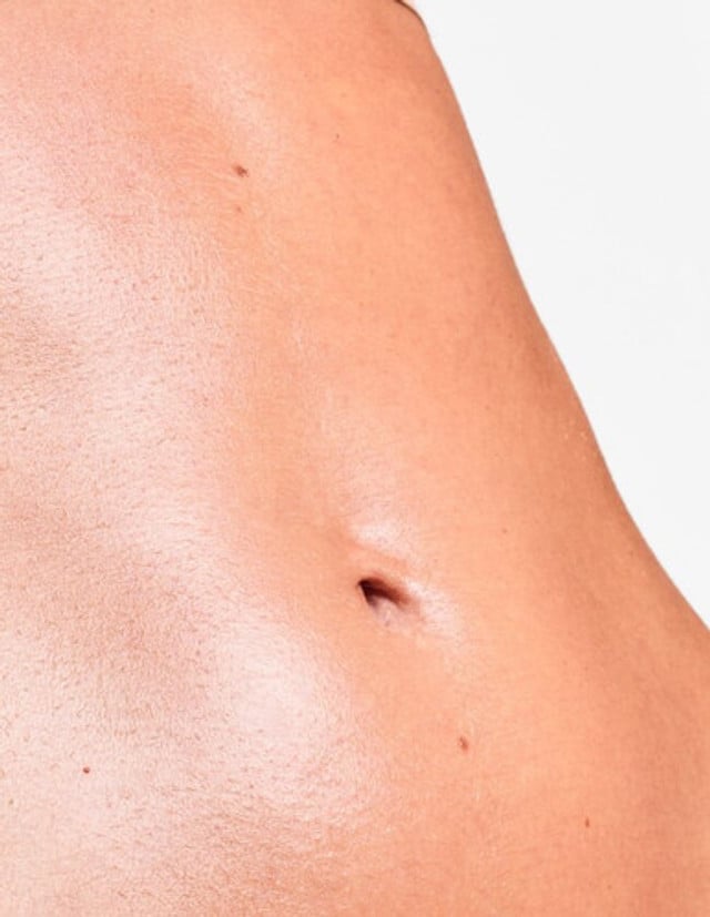 Skin Needling Stomach product image