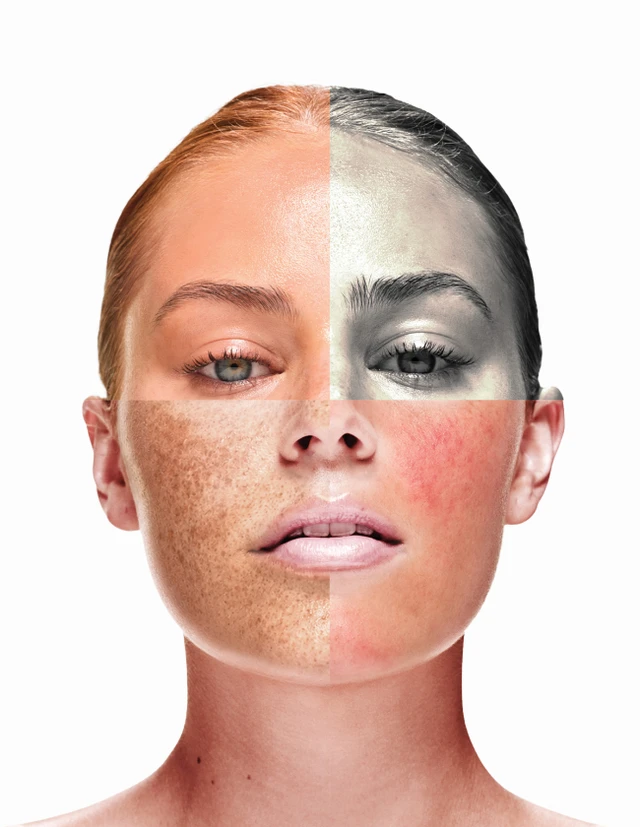 Skin360 Consultation product image