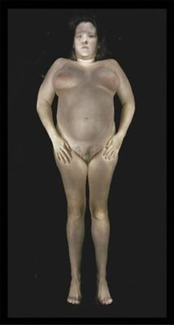 Gary Schneider: Nudes Gary Schneider: Nudes