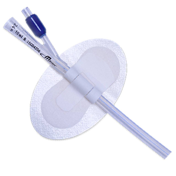 Catheter Securement Device | Mdevices