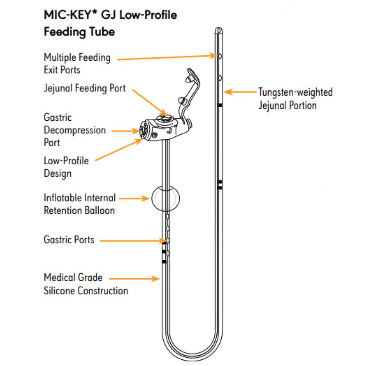 Mic-Key Low-Profile Balloon Gastric-Jejunal Feeding Tube with Enfit Extension Kit