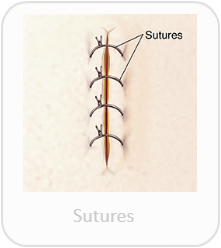 Sutures