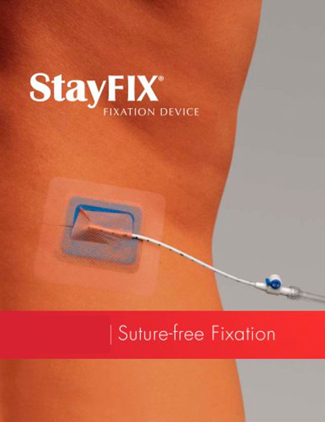 Merit StayFix Catheter Fixation Device, Sterile 5-12CH (680ME) 12-22CH (685ME)