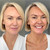Before and after results of the Sienna X self tan serum drops on a blonde female