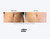 Million Dollar Facial Bio-Cell XO+ exosomes 5ml (5)