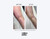 Before and after images of an arm using the Million Dollar Empire microneedling pen.